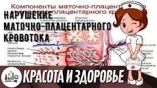 Нарушение маточно-плацентарного кровотока