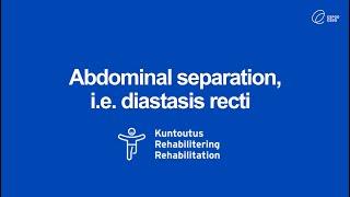 Abdominal separation i.e. diastasis recti