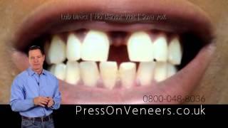 PressOn Veneers by Brighter Image Lab - Now in the UK