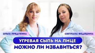 Замучала угревая сыпь? Как избавиться навсегда