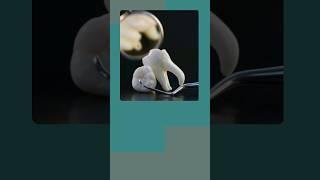 General Dentistry at @AraratDental  #dentist #dentalprocedure #dentalbridge #wisdomtoothremoval