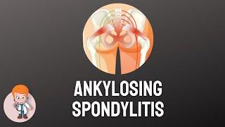 Ankylosing Spondylitis: Symptoms, Causes, Diagnosis and treatment