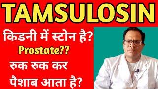 Tamsulosin Uses in Hindi | Tamsulosin Hydrochloride Tablet Review | Tamsulosin 0.4mg |