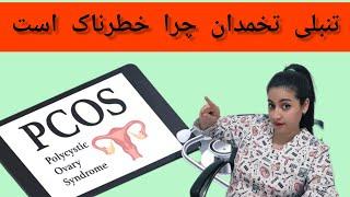 علت pcos یا سندرم تخمدان پلی کیستیک / علایم / معیارهای تشخیص / عوارض / درمان