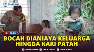 PILU, Kronologi Bocah di Nias Selatan Disiksa Keluarga Bertahun-Tahun, Kaki Patah dan Cacat