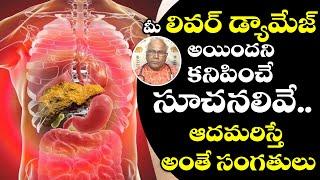 Liver cirrhosis | Symptoms To Recognise Liver Damage | Liver Problems | Dr. CL Venkat Rao | TX TV