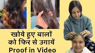 Lost Hair Growth Challenge खोये हुए बालों को फिर से उगायें | Smooth Shiny Hair | Dr. Upasana Vohra