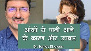 Watery Eyes Causes Symptoms and Treatment: आंखों से पानी आने के कारण और उपचार | Dr Sanjay Dhawan