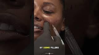 FANTASTIC FEMALE FACIAL SCULPTING | Dr. Jason Emer #shortsvideo #shorts #reels #dermatology #doctor