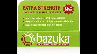 Bazuka Extra Strength Treatment Gel review - how to treat verrucas and warts with bazuka sub-zero
