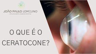 O que é o Ceratocone? | Dr. João Paulo Lomelino