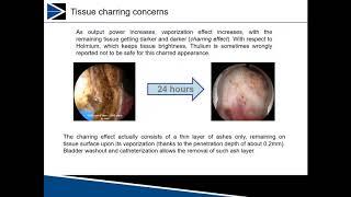 Richard Grunert, MD - Thulium Webinar | ForTec Medical