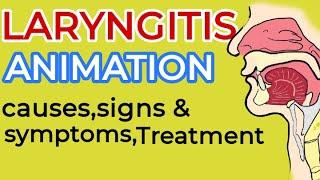 Laryngitis | Laryngitis symptoms | Laryngitis treatment | Laryngitis animation | what is Laryngitis