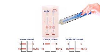 Экспресс-тест NADAL Нb/Нp на комплекс гемоглобин-гаптоглобин