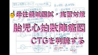 CTGの判読〜胎児心拍数陣痛図〜