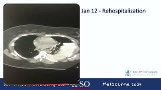 Management of Challenging Surgical Complications: Learning from Real Cases | IFSO Melbourne 2024