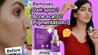 Derma co Kojic acid face wash and serum for 1 month | Honest Review #skincare