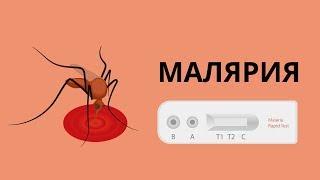 Малярия возбудитель, симптомы и метод экспресс диагностики