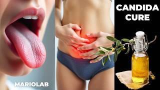 The Shocking Truth About Candida – Natural Cures That Actually Work!