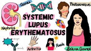 Systemic Lupus Erythematosus | SLE | Pathophysiology, Diagnosis, Treatment | Rheumatology