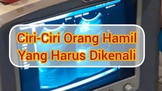 9 Ciri-Ciri Orang Hamil Akurat