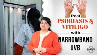 Narrowband UVB Phototherapy for Vitiligo and Psoriasis