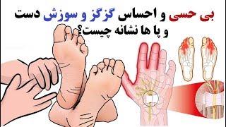 بی حسی دست و احساس گزگز و سوزش دست و پا ها نشانه چیست؟