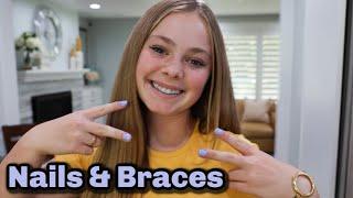 Olivia Got Braces! Nails and Braces MATCH!