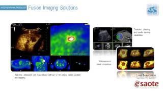 Fusion Imaging Solutions: BodyMap, Virtual Navigator & Navigator in all applications