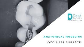 Anatomical modeling occlusal surface