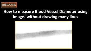 How to measure Blood Vessel Diameter using ImageJ without drawing many lines
