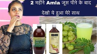 Benefits for amla juice|aloevera juice|amla juice ke fayede|kapiva amla and aloevera juice