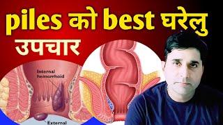 Piles ka gharelu upchar nepali//piles ko aushadhi //healthtipsnepali //