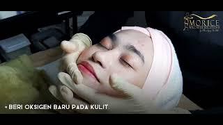 HYDRAFACIAL | BENEFIT OF HYDRAFACIAL | IMORICE WELLNESS SOLUTIONS | SPA SHAH ALAM