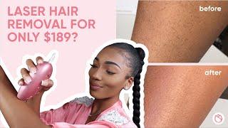 LASER HAIR REMOVAL AT HOME?? *RoseSkinCo Lumi*