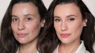 I've tried different methods and this is the best way to cover melasma | ALI ANDREEA