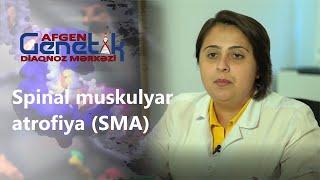 Spinal muskulyar atrofiya (SMA)  - südəmər dövrün və uşaqlıq çağının genetik motor neyron xəstəliyi