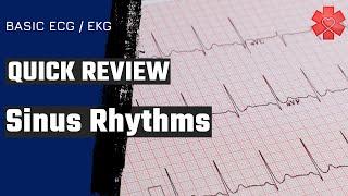 Sinus Rhythms: What You Need to Know