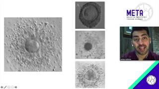 Oocyte factors to consider for embryo selection : Dr. Keshav Malhotra