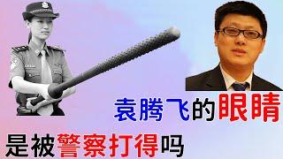 研究缘由：袁腾飞“反党、反政府、反社会主义、反毛主席”，2010年5月被北京公安局抓了，随后释放，什么事也没有，但眼睛外观出现问题。