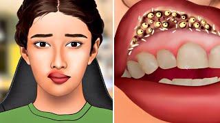 "ASMR: Removing Giant Botfly Maggots from a Mountaineer’s Mouth! (Satisfying Dental Animation)"