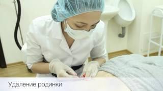 Удаление новообразований (родинок) в NEO-Clinic