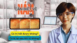 BỊ NÁM KHÔNG ĐÁNG SỢ! Xem video này để tránh các sai lầm khi điều trị nám.