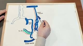 Why Varicocele Embolization and Laparoscopic Surgery are having so much Recurrence?