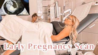 Early Pregnancy Scan | Transvaginal Ultrasound | Signs Of Bleeding | First Trimester Pregnancy Vlog