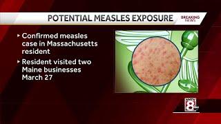 Maine CDC warns of potential measles exposure