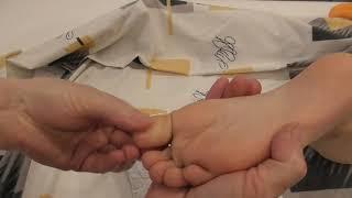 массаж стопы ребенку при плоскостопии