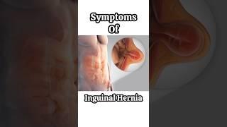 Inguinal hernia symptoms I Hernia treatment in Delhi