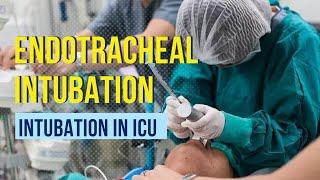 #Endotracheal #intubation: Step by step procedure