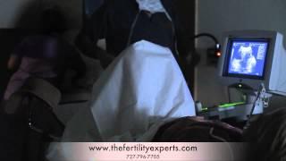 IVF Embryo Transfer